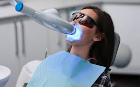 Blanchiment dentaire